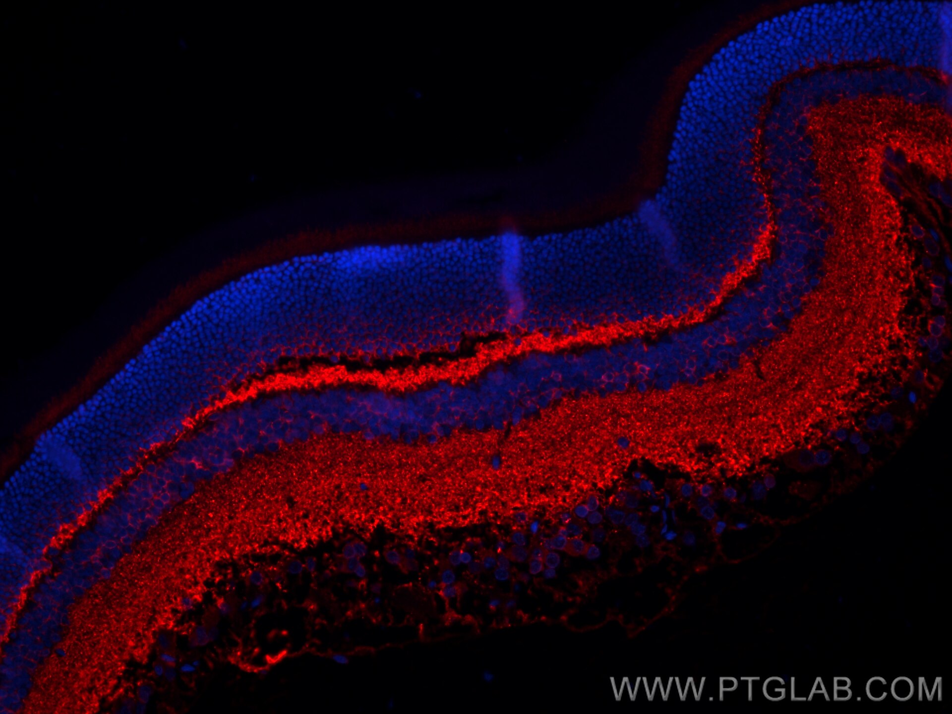 Immunofluorescence (IF) / fluorescent staining of rat eye tissue using CPLX3 Polyclonal antibody (16949-1-AP)