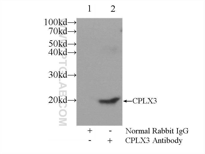 Immunoprecipitation (IP) experiment of mouse brain tissue using CPLX3 Polyclonal antibody (16949-1-AP)