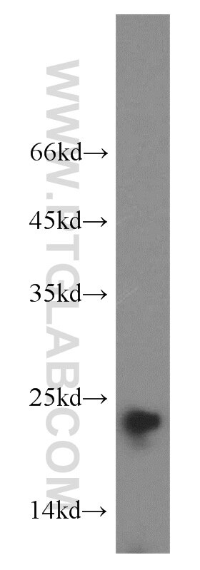 Western Blot (WB) analysis of human brain tissue using CPLX3 Polyclonal antibody (16949-1-AP)