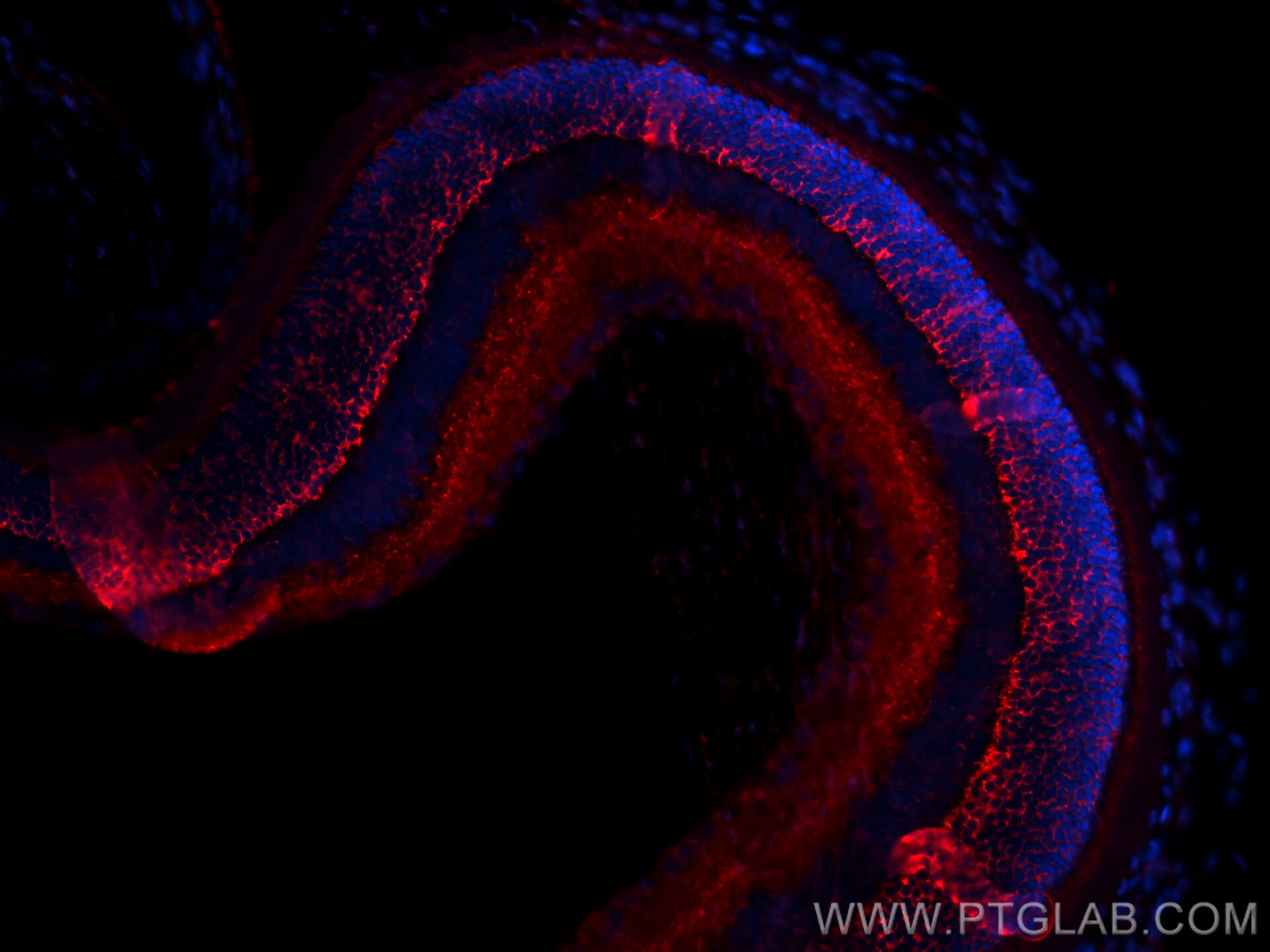 Immunofluorescence (IF) / fluorescent staining of rat eye tissue using CPLX4 Polyclonal antibody (21222-1-AP)