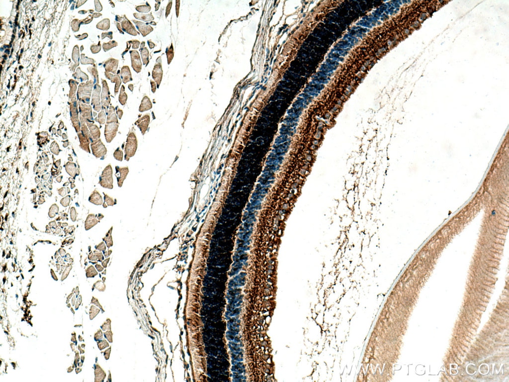 Immunohistochemistry (IHC) staining of mouse eye tissue using CPLX4 Polyclonal antibody (21222-1-AP)