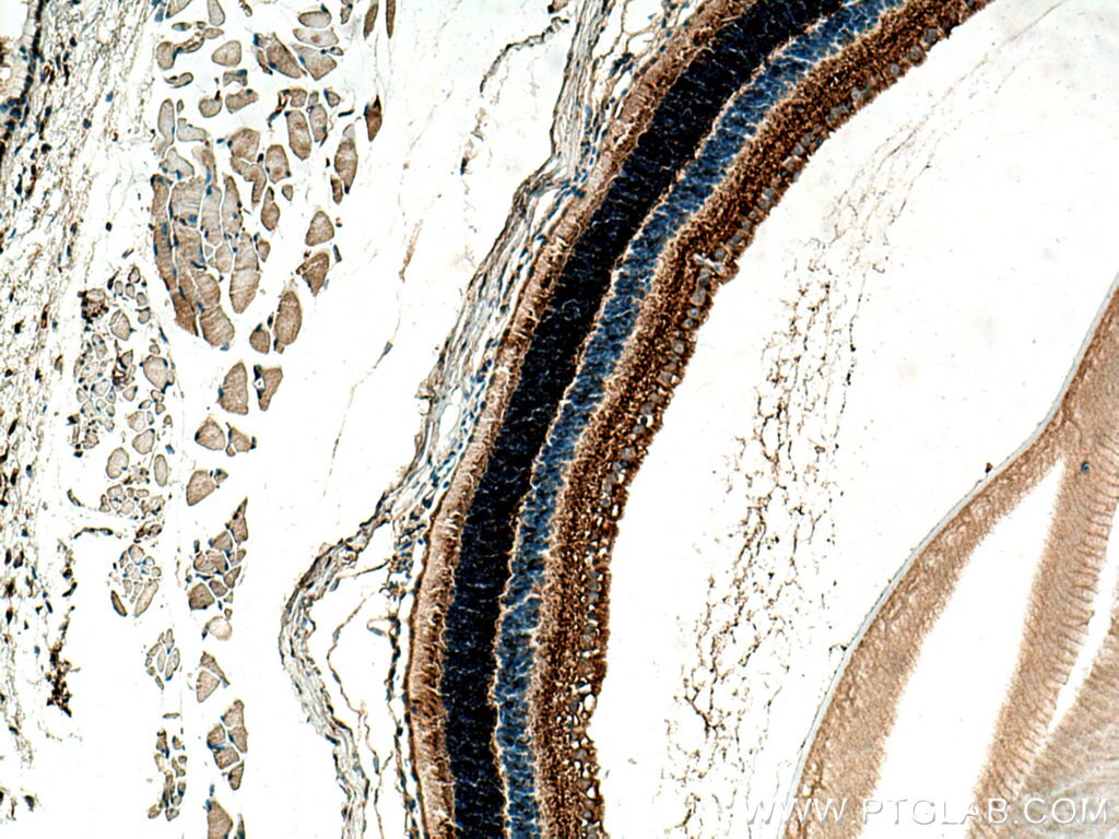 IHC staining of mouse eye using 21222-1-AP