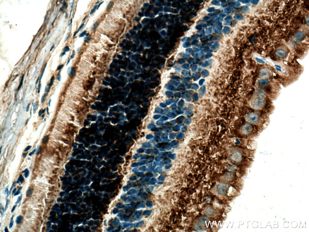 Immunohistochemistry (IHC) staining of mouse eye tissue using CPLX4 Polyclonal antibody (21222-1-AP)