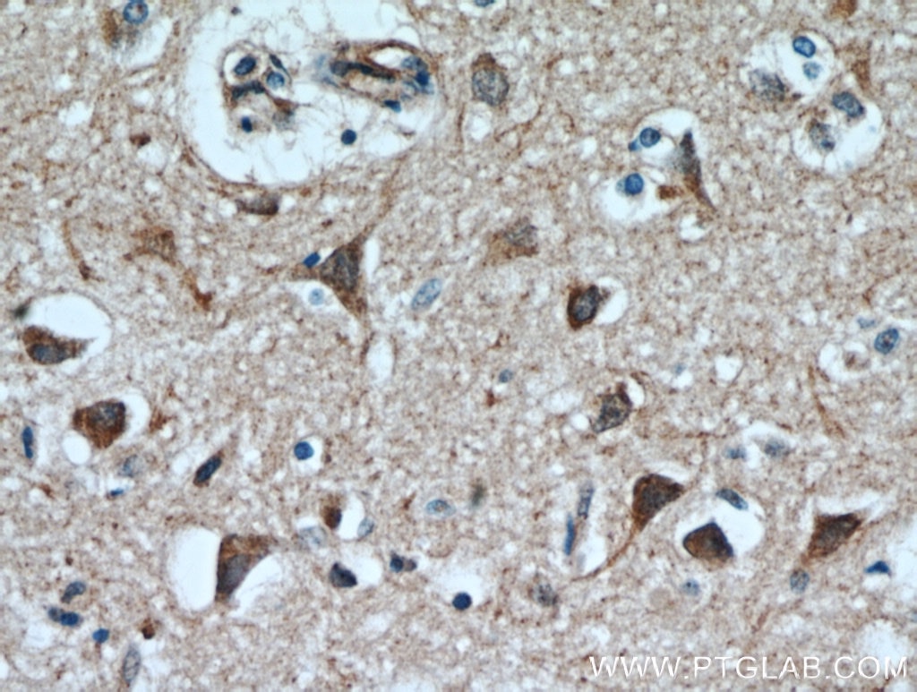Immunohistochemistry (IHC) staining of human brain tissue using CPLX4 Polyclonal antibody (21222-1-AP)