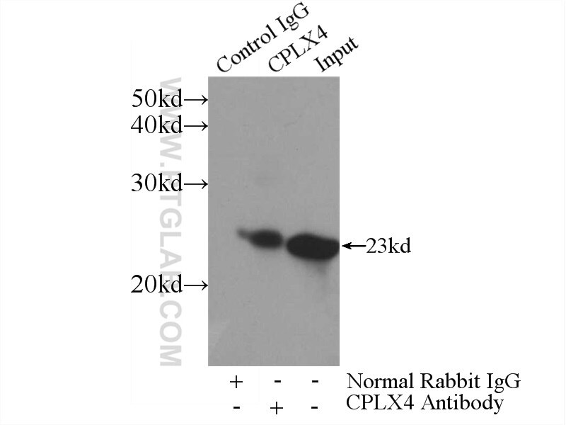 Immunoprecipitation (IP) experiment of Y79 cells using CPLX4 Polyclonal antibody (21222-1-AP)