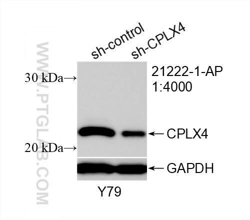 Western Blot (WB) analysis of Y79 cells using CPLX4 Polyclonal antibody (21222-1-AP)