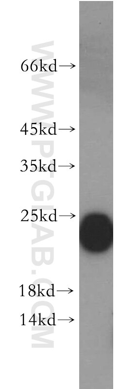 Western Blot (WB) analysis of Y79 cells using CPLX4 Polyclonal antibody (21222-1-AP)