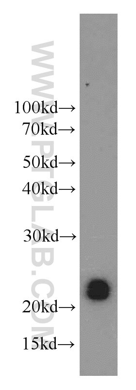 Western Blot (WB) analysis of Y79 cells using CPLX4 Polyclonal antibody (21222-1-AP)