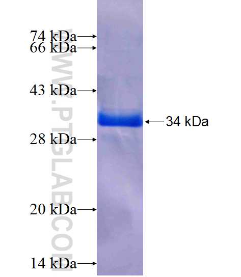 CPLX4 fusion protein Ag15661 SDS-PAGE