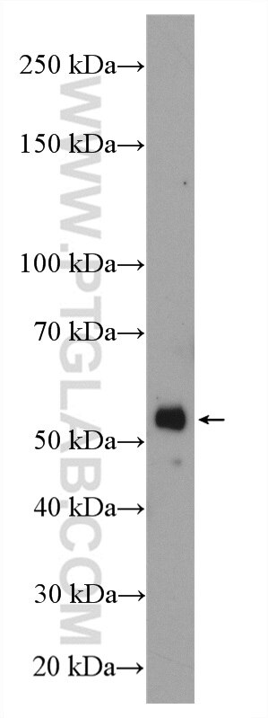 WB analysis of mouse liver using 16440-1-AP