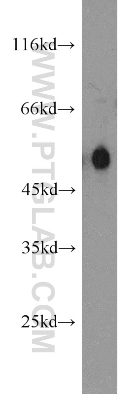 Western Blot (WB) analysis of HEK-293 cells using Carboxypeptidase M Polyclonal antibody (16440-1-AP)
