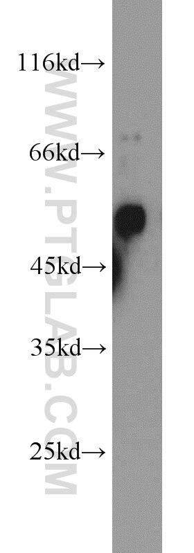 Western Blot (WB) analysis of HEK-293 cells using Carboxypeptidase M Polyclonal antibody (16440-1-AP)