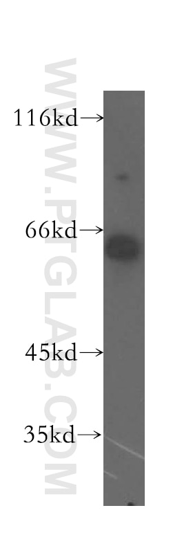 Carboxypeptidase M