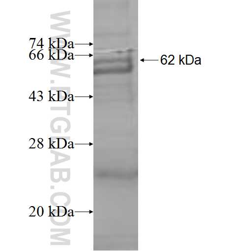 CPM fusion protein Ag9761 SDS-PAGE