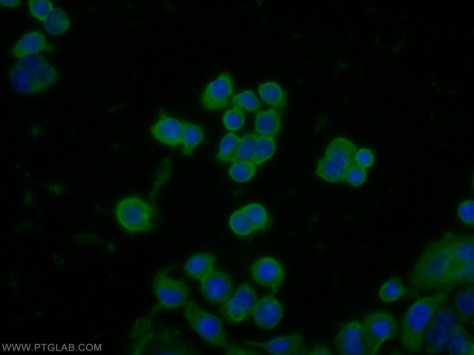 Immunofluorescence (IF) / fluorescent staining of COLO 320 cells using CPN1 Polyclonal antibody (13385-1-AP)