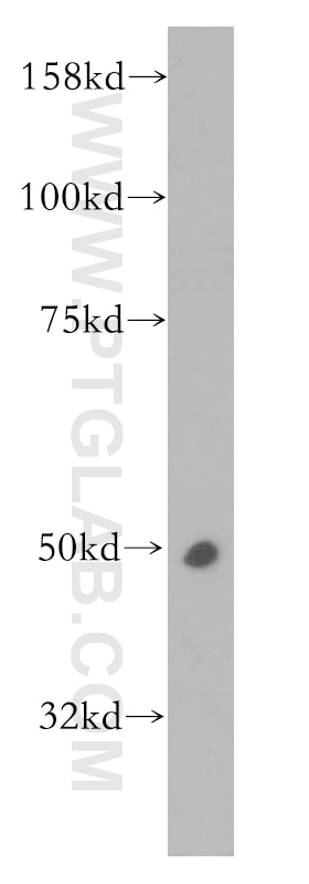 Western Blot (WB) analysis of Raji cells using CPN1 Polyclonal antibody (13385-1-AP)
