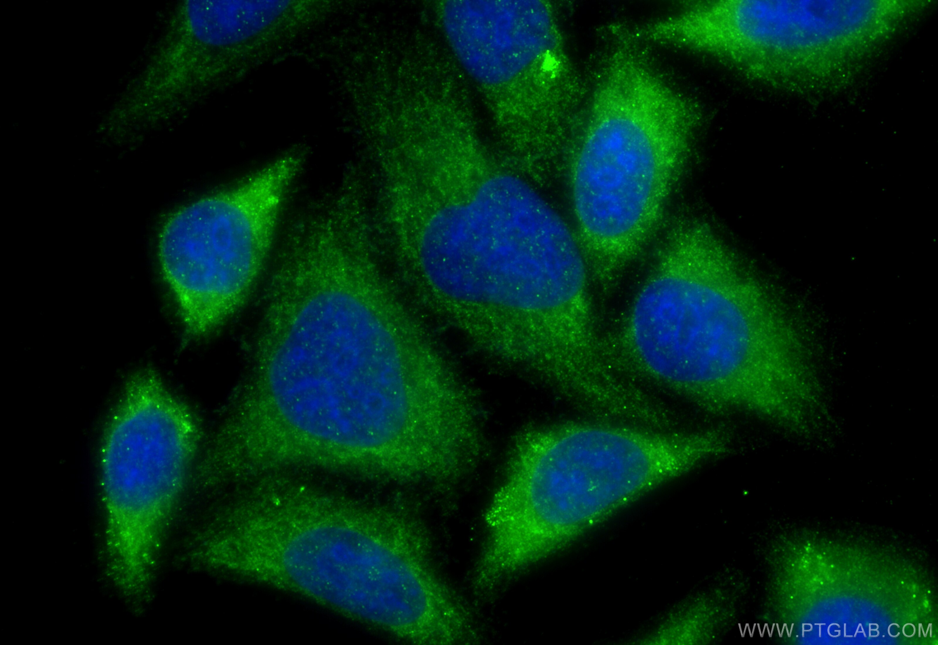 Immunofluorescence (IF) / fluorescent staining of HepG2 cells using CPN1 Polyclonal antibody (31940-1-AP)