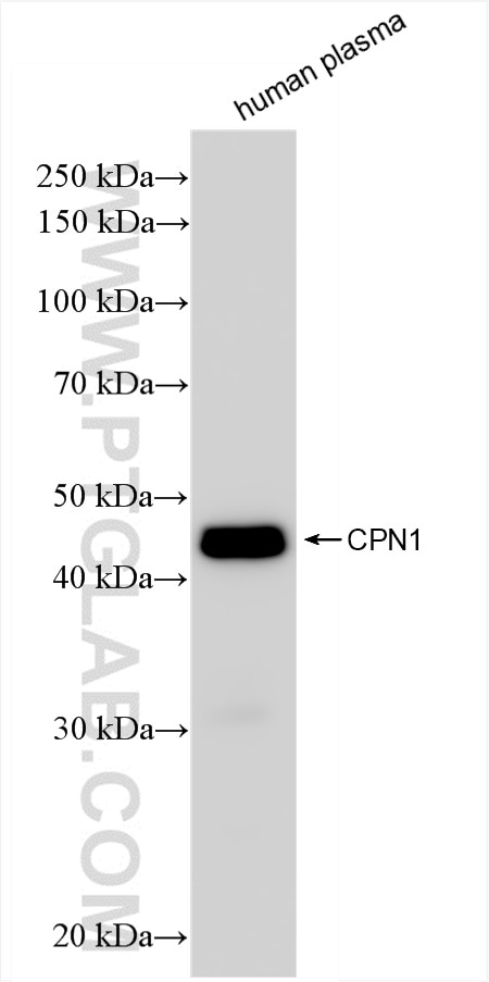 Western Blot (WB) analysis of human plasma using CPN1 Recombinant antibody (84218-1-RR)