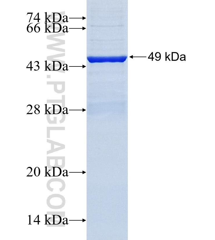 CPN1 fusion protein Ag34806 SDS-PAGE