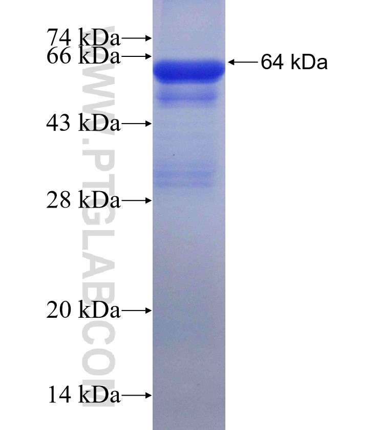 CPN1 fusion protein Ag4035 SDS-PAGE