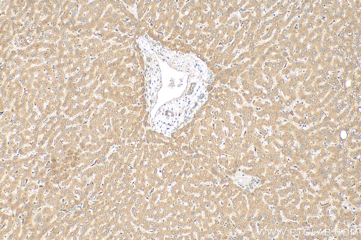 Immunohistochemistry (IHC) staining of human liver tissue using CPN2 Polyclonal antibody (27160-1-AP)