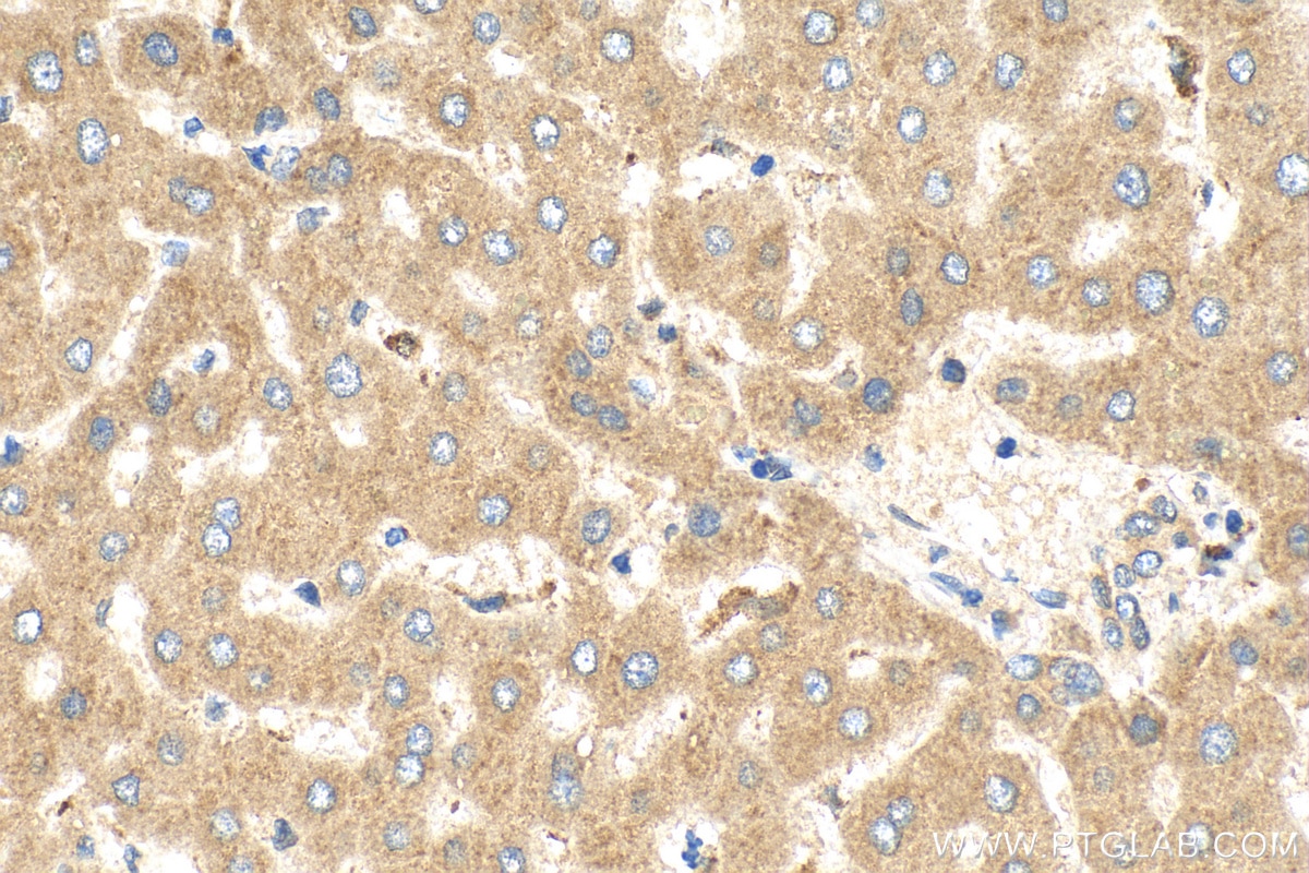 Immunohistochemistry (IHC) staining of human liver tissue using CPN2 Polyclonal antibody (27160-1-AP)