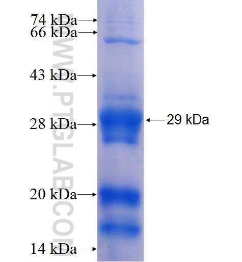 CPN2 fusion protein Ag25801 SDS-PAGE