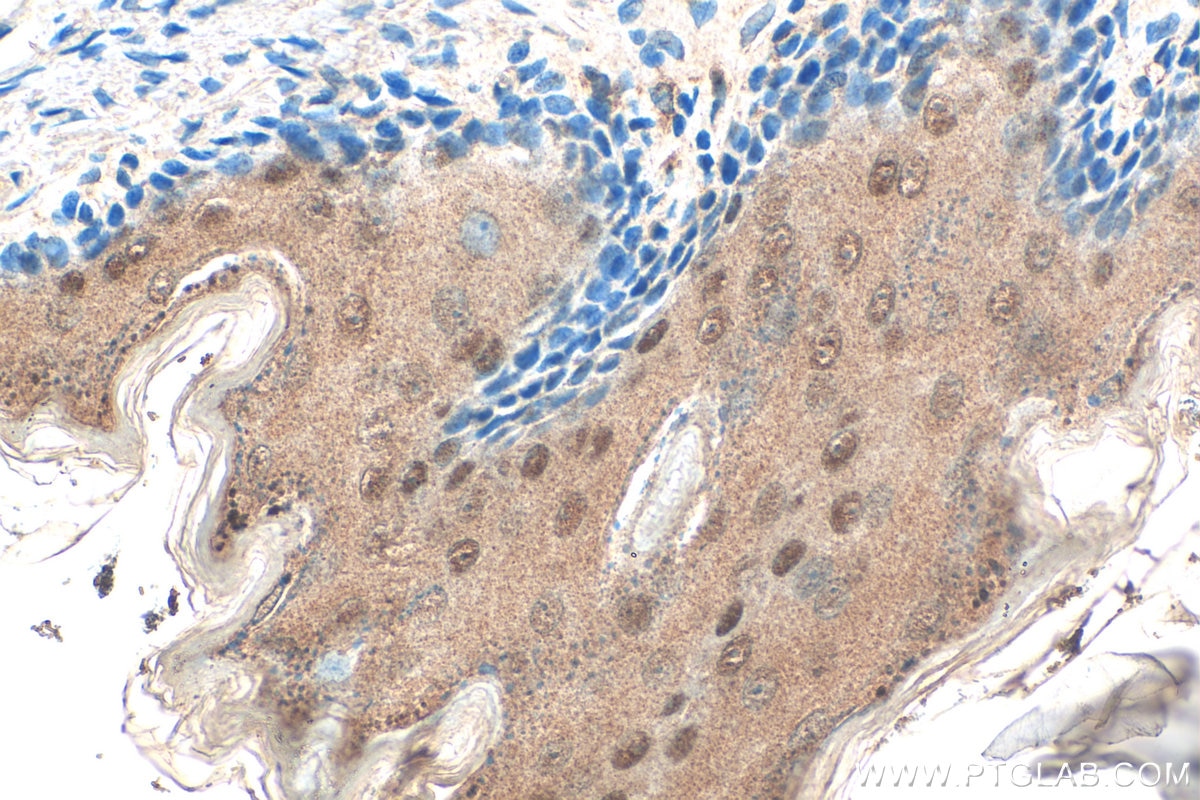 Immunohistochemistry (IHC) staining of rat stomach tissue using CPNE1 Polyclonal antibody (10126-2-AP)