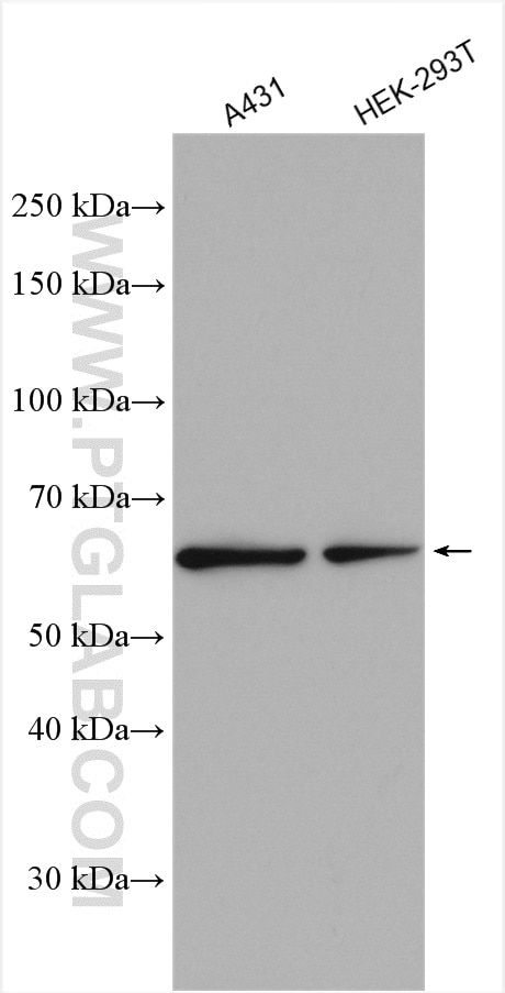 Western Blot (WB) analysis of various lysates using CPNE1 Polyclonal antibody (10126-2-AP)