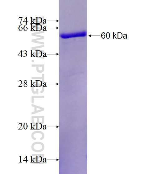 CPNE1 fusion protein Ag0139 SDS-PAGE