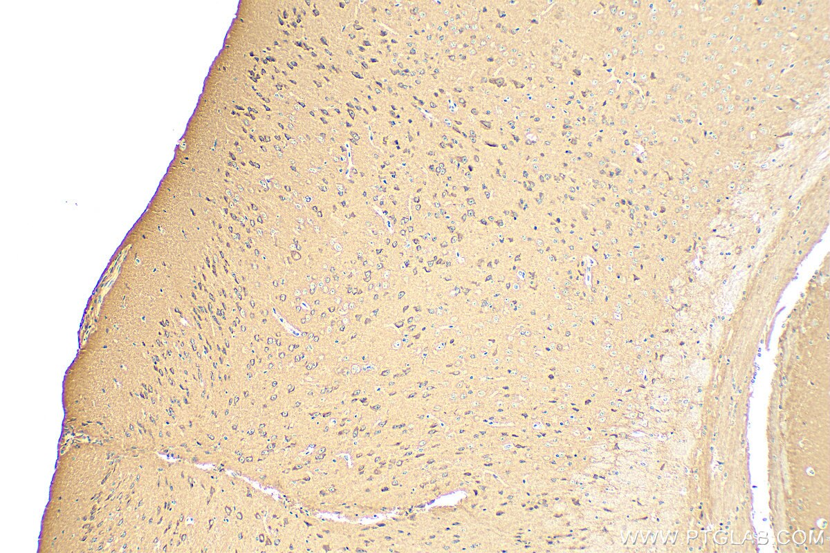 Immunohistochemistry (IHC) staining of mouse brain tissue using CPNE2 Polyclonal antibody (17664-1-AP)