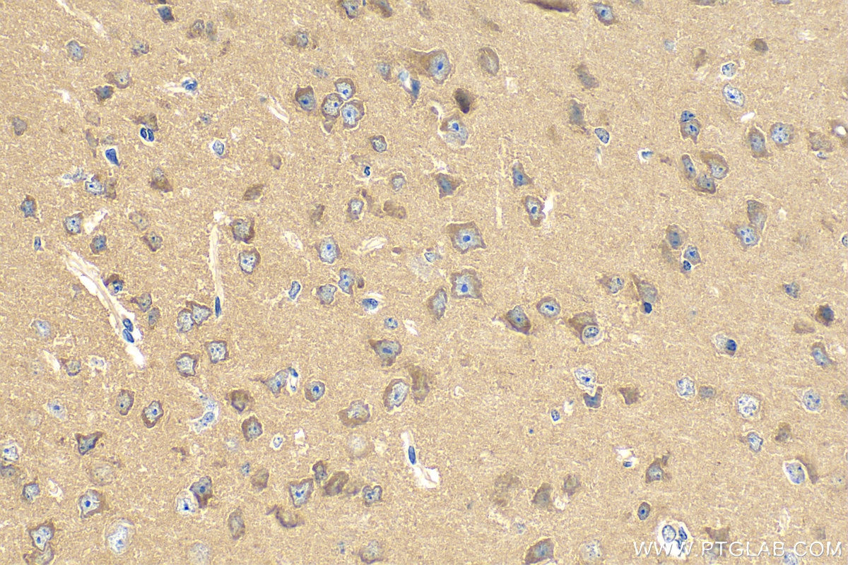 Immunohistochemistry (IHC) staining of mouse brain tissue using CPNE2 Polyclonal antibody (17664-1-AP)