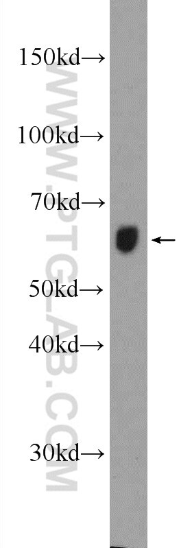 CPNE2 Polyclonal antibody