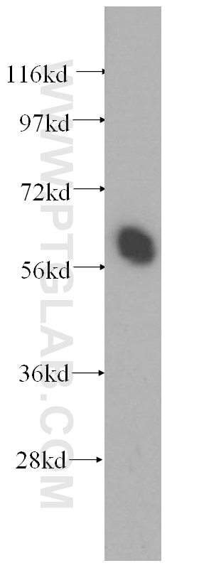 Western Blot (WB) analysis of Y79 cells using CPNE3 Polyclonal antibody (11186-1-AP)