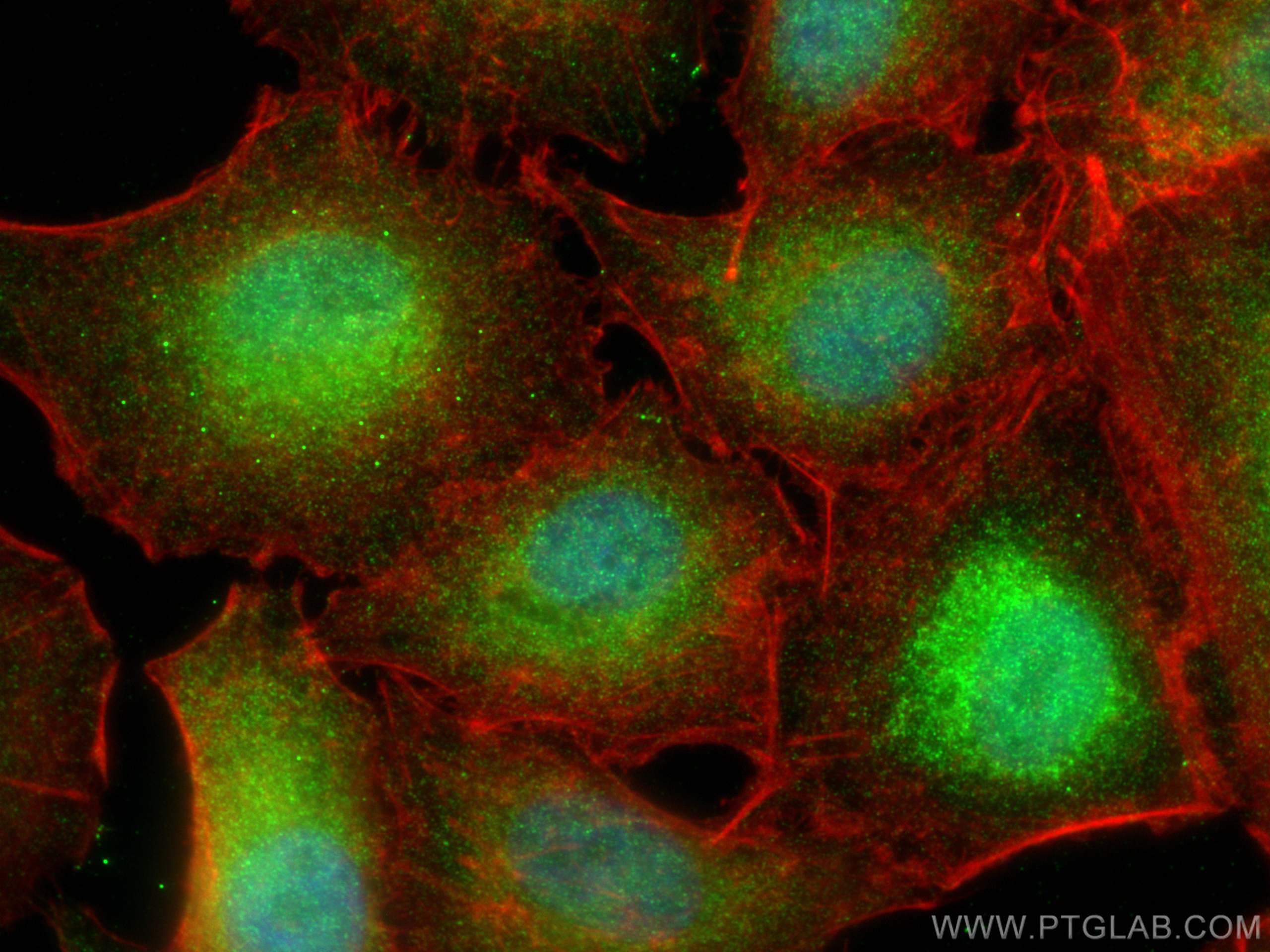 Immunofluorescence (IF) / fluorescent staining of A549 cells using CPNE4 Polyclonal antibody (16075-1-AP)