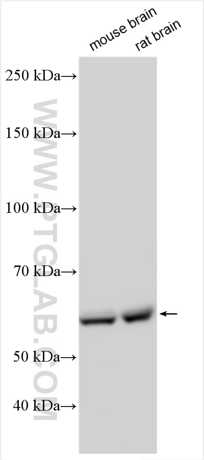 Western Blot (WB) analysis of various lysates using CPNE4 Polyclonal antibody (16075-1-AP)