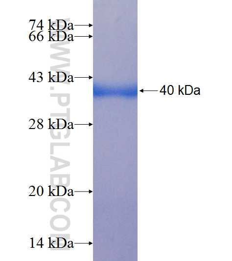 CPNE4 fusion protein Ag9062 SDS-PAGE