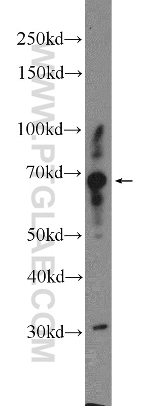 Western Blot (WB) analysis of mouse embryo tissue using CPNE5 Polyclonal antibody (18097-1-AP)