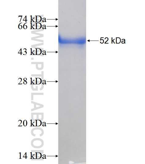CPNE5 fusion protein Ag11987 SDS-PAGE