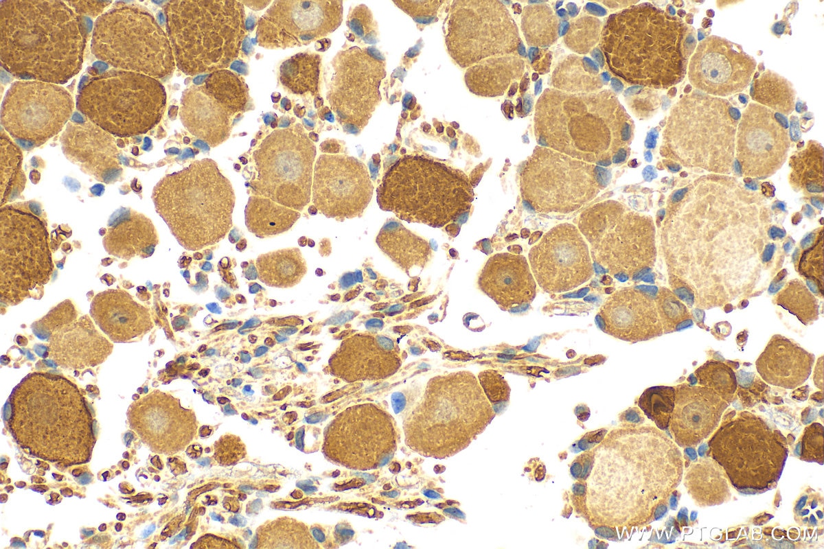Immunohistochemistry (IHC) staining of rat dorsal root ganglion tissue using CPNE6 Polyclonal antibody (13782-1-AP)