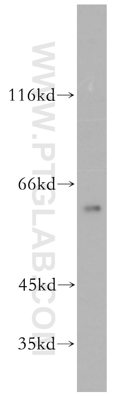 CPNE6 Polyclonal antibody