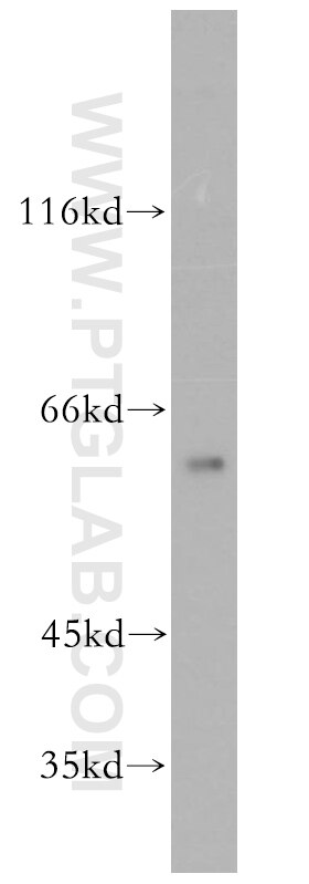 CPNE6 Polyclonal antibody