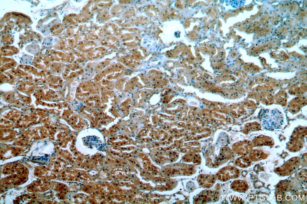 Immunohistochemistry (IHC) staining of human kidney tissue using CPNE8 Polyclonal antibody (20097-1-AP)