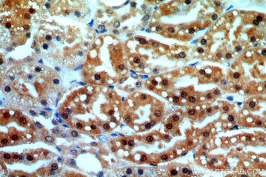 Immunohistochemistry (IHC) staining of human kidney tissue using CPNE8 Polyclonal antibody (20097-1-AP)