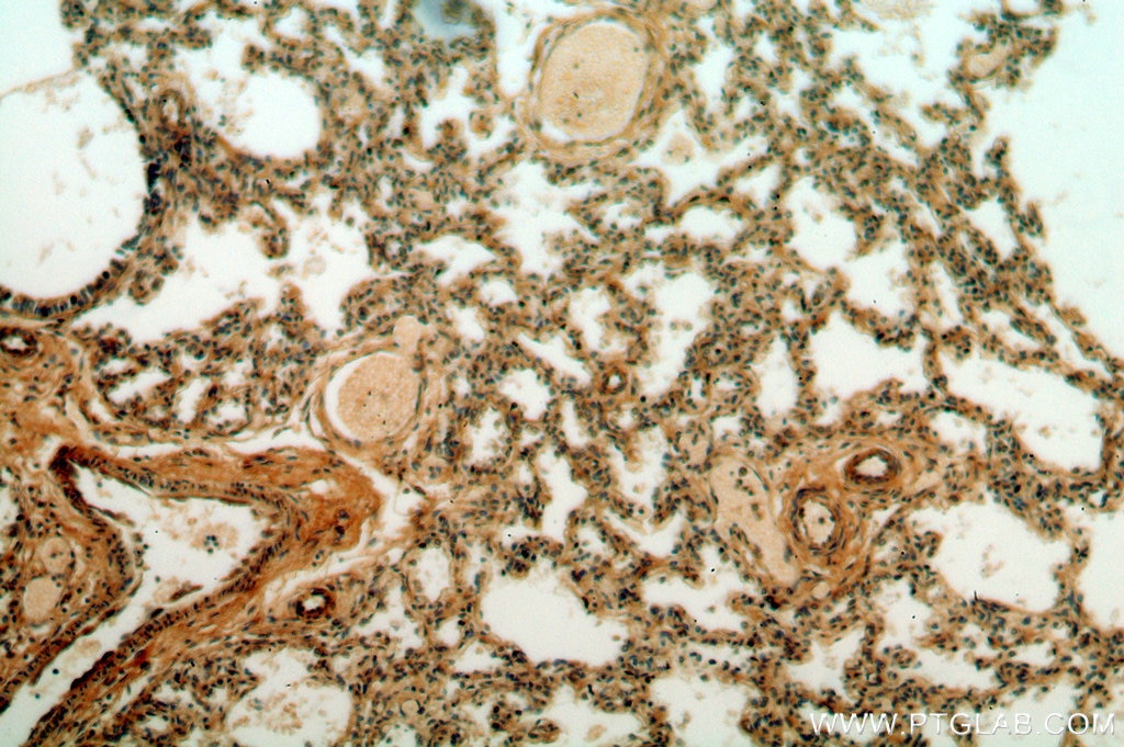 Immunohistochemistry (IHC) staining of human lung tissue using CPNE8 Polyclonal antibody (20097-1-AP)