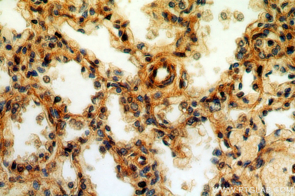 Immunohistochemistry (IHC) staining of human lung tissue using CPNE8 Polyclonal antibody (20097-1-AP)