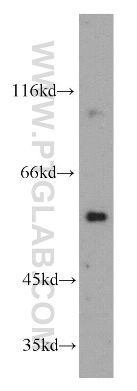 Western Blot (WB) analysis of mouse brain tissue using CPNE9-Specific Polyclonal antibody (20098-1-AP)