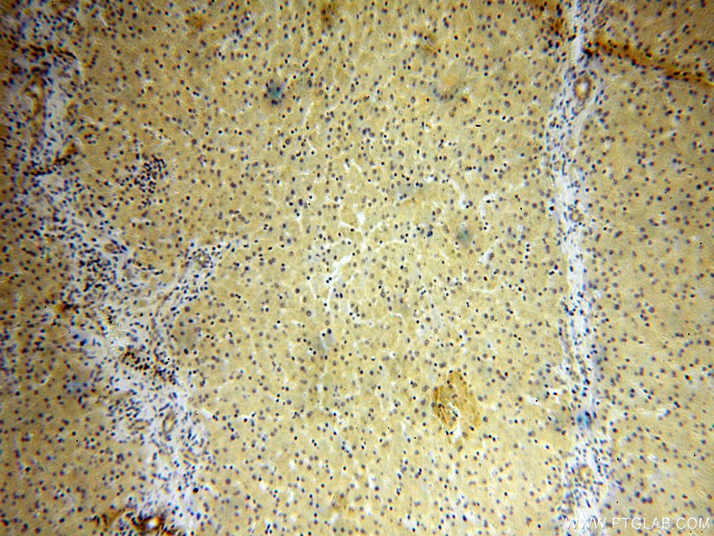 Immunohistochemistry (IHC) staining of human liver tissue using CPOX Polyclonal antibody (12211-1-AP)