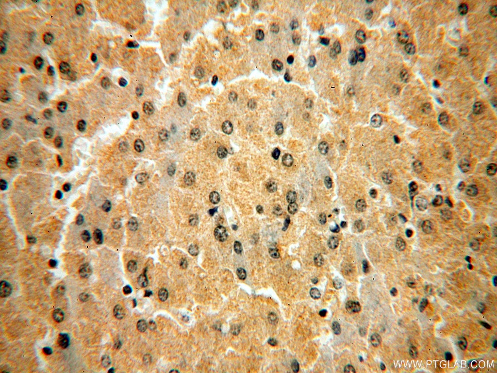 Immunohistochemistry (IHC) staining of human liver tissue using CPOX Polyclonal antibody (12211-1-AP)