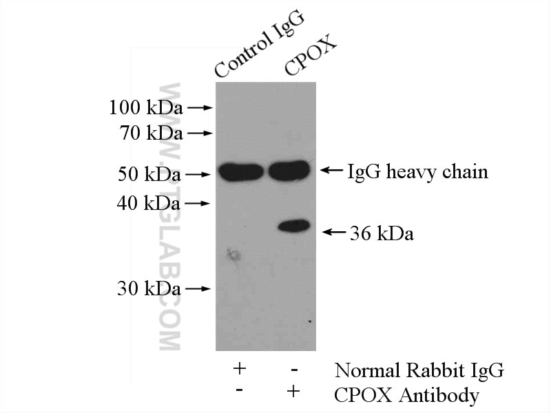Immunoprecipitation (IP) experiment of HepG2 cells using CPOX Polyclonal antibody (12211-1-AP)